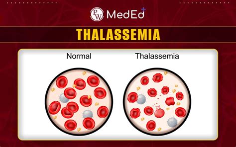 types of beta thalassemia|Thalassemia: Types, Traits, Symptoms & Treatment.